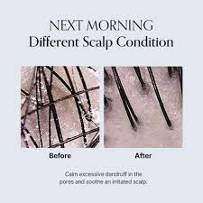 GROWUS Damage Therapy Scalp Scaling Ampoule 50g - Siero per cuoio capelluto