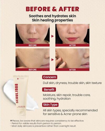 K-SECRET SEOUL 1988 Cream: Snail Mucin 93% + Rice 100ml - Crema viso con bava di lumaca e riso