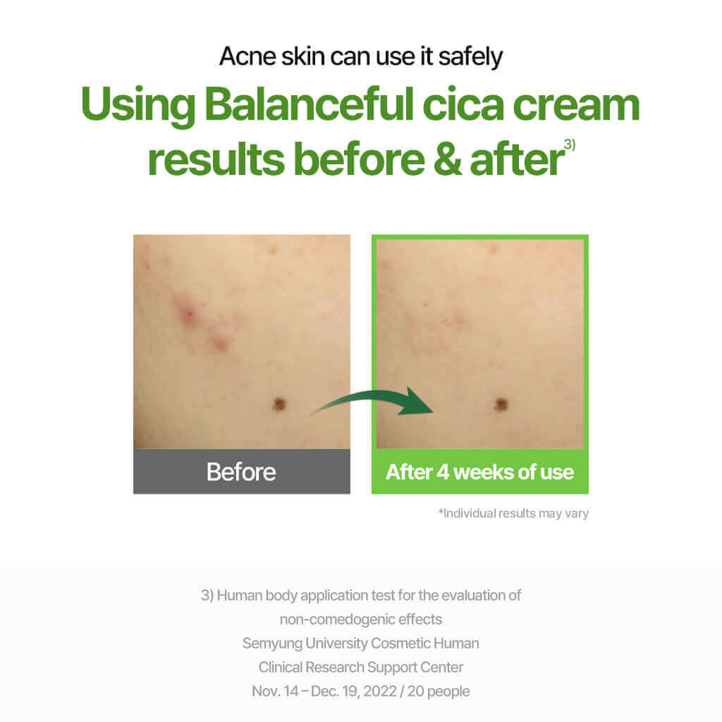 TORRIDEN Balanceful Cica Cream 80ml - Crema viso lenitiva