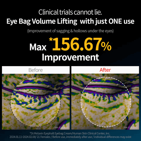 DR.MELAXIN Eyephalt Eyebag Cream 10ml - Crema contorno occhi