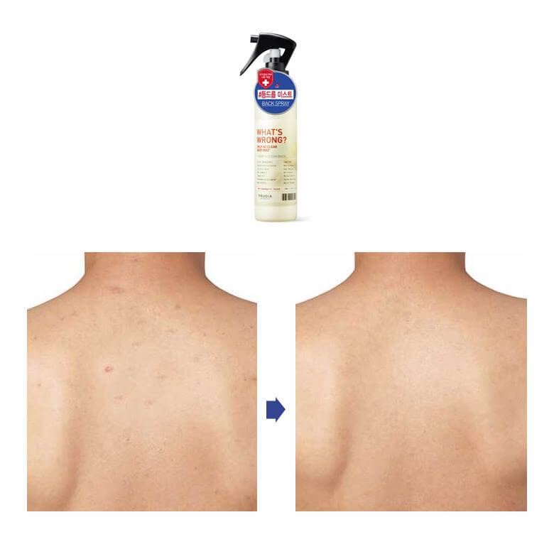 FRUDIA What's Wrong Help AC Clear Body Mist 150ml - Spray corpo anti-imperfezioni lenitivo