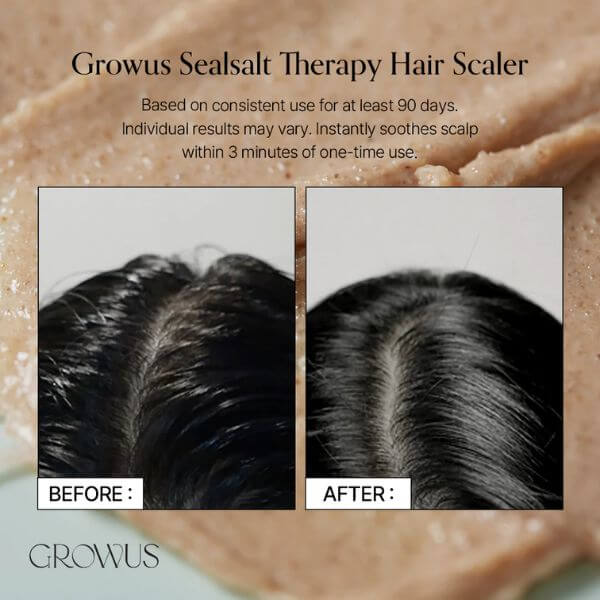 GROWUS Sea Salt Therapy Scalp Scaler 120g - Scrub coreano per lo scalpo